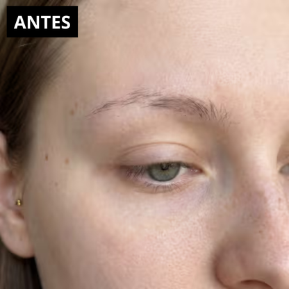 Serum | Crecimiento de Cejas