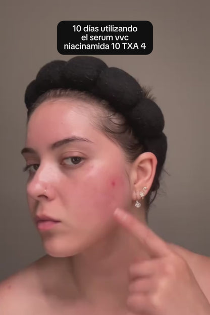 Serum Anti-Manchas de Alta Potencia