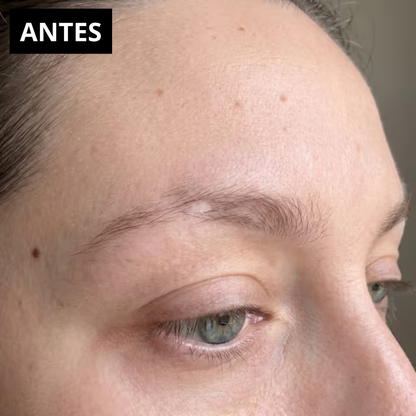 Serum | Crecimiento de Cejas