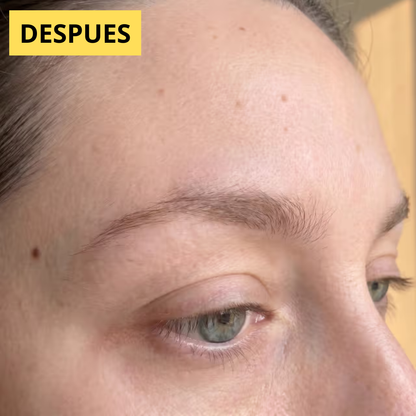 Serum | Crecimiento de Cejas